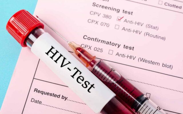 Does Anal Sex Cause HIV?