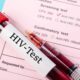 Does Anal Sex Cause HIV?